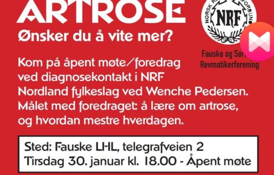 Åpent temamøte om Artrose